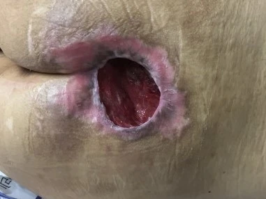 부안방문간호센터 사진 6