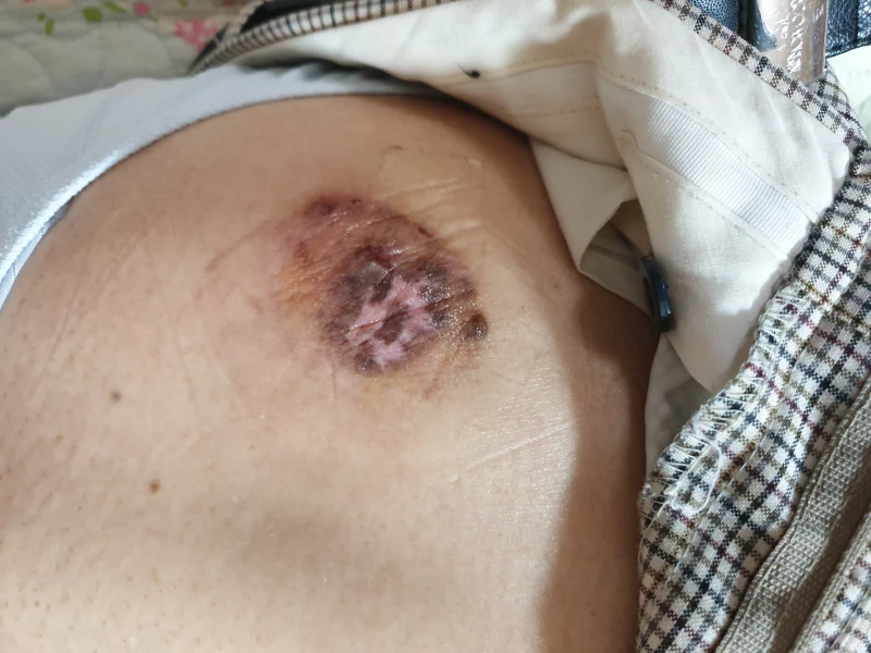 부안방문간호센터 사진 10